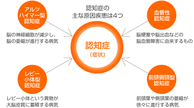 認知症の主な原因疾患は4つ