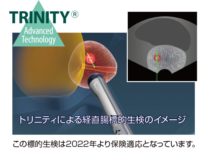 トリニティによる経直腸標的生検のイメージ