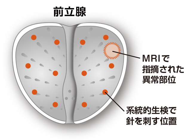 系統的生検イメージ図