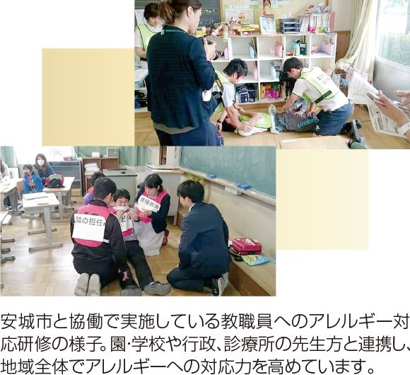 正常な頸椎と後弯した頸椎