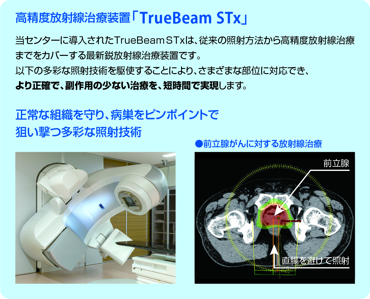 高精度放射線治療装置「TrueBeam STx」、脳定位放射線治療:SRS、SRT、体幹部定位放射線治療:SBRT、強度変調放射線治療:IMRT、強度変調回転放射線治療:VMAT、画像誘導放射線治療:IGRT